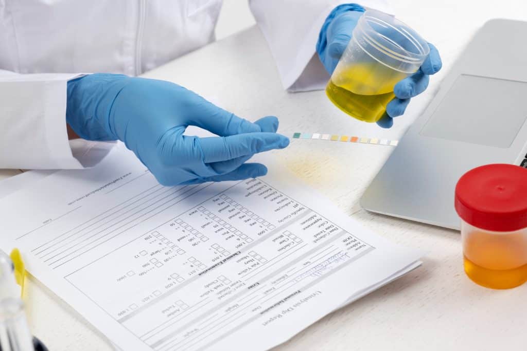 delta 9 urine testing - how long does delta 9 stay in your system?